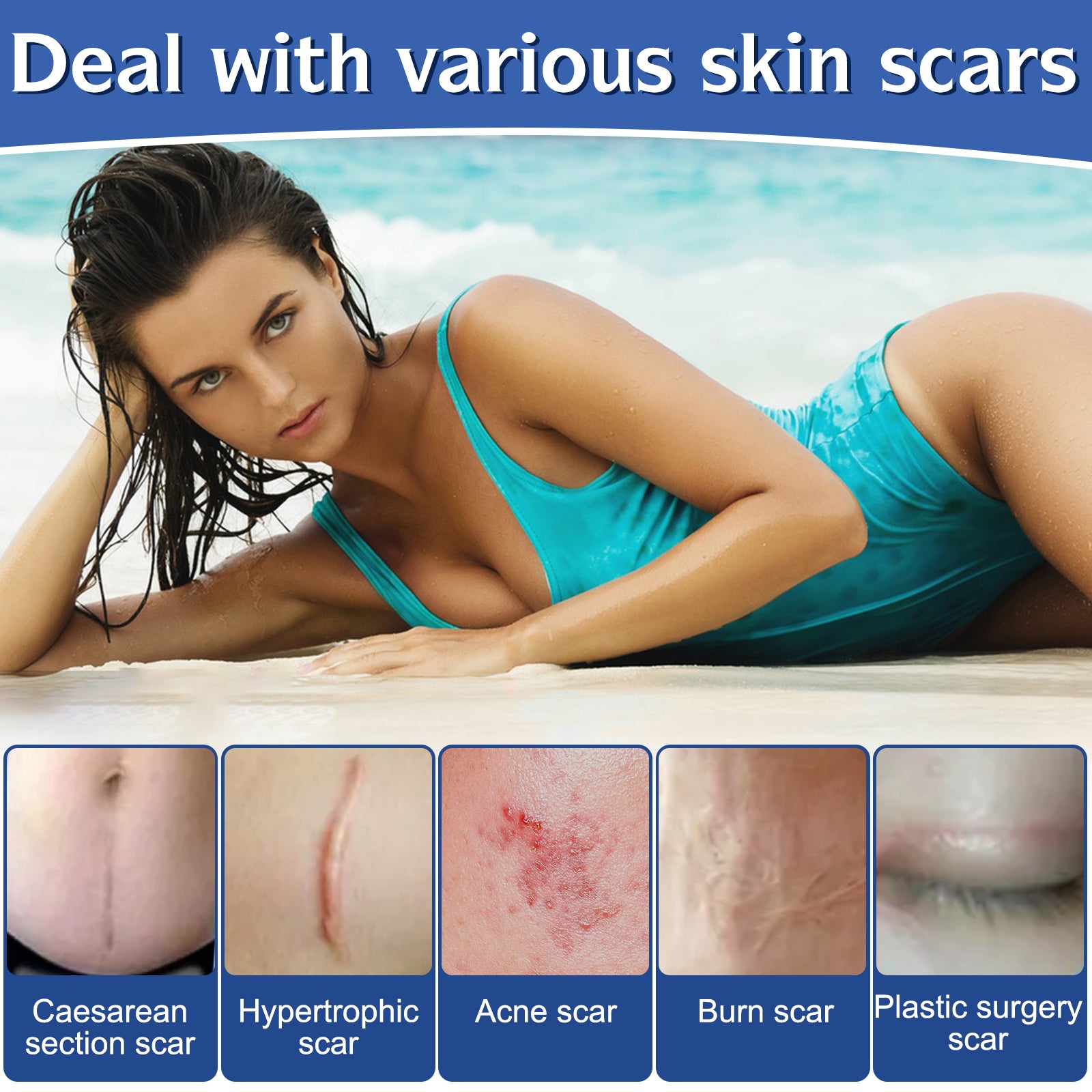 Silicone gel sheets for store acne scars